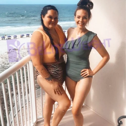 Weight Loss Surgery Before and After Sarah L - 1 Year Update*